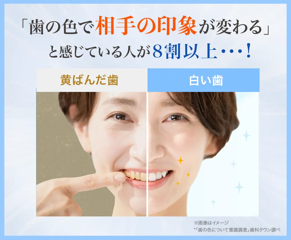 「歯の色で相手の印象が変わる」と感じている人が8割以上・・・！